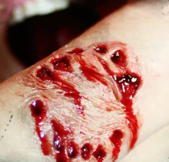 Vampire Bite Wound Prosthetic- Tinsley Transfers